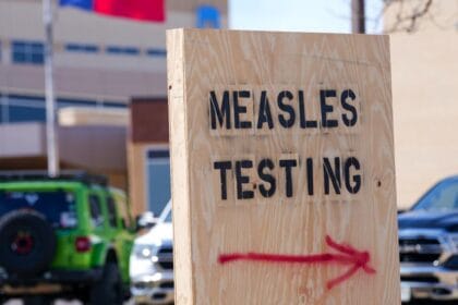 Texas measles: 6 people with symptoms in Williamson County, DSHS says