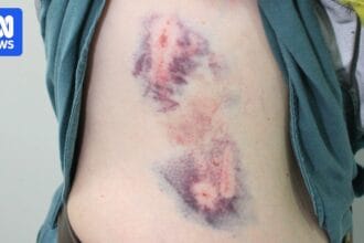 Almost 150 dog attacks reported by Ergon Energy workers across Queensland in 12 months
