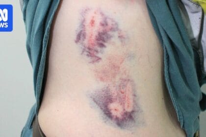 Almost 150 dog attacks reported by Ergon Energy workers across Queensland in 12 months